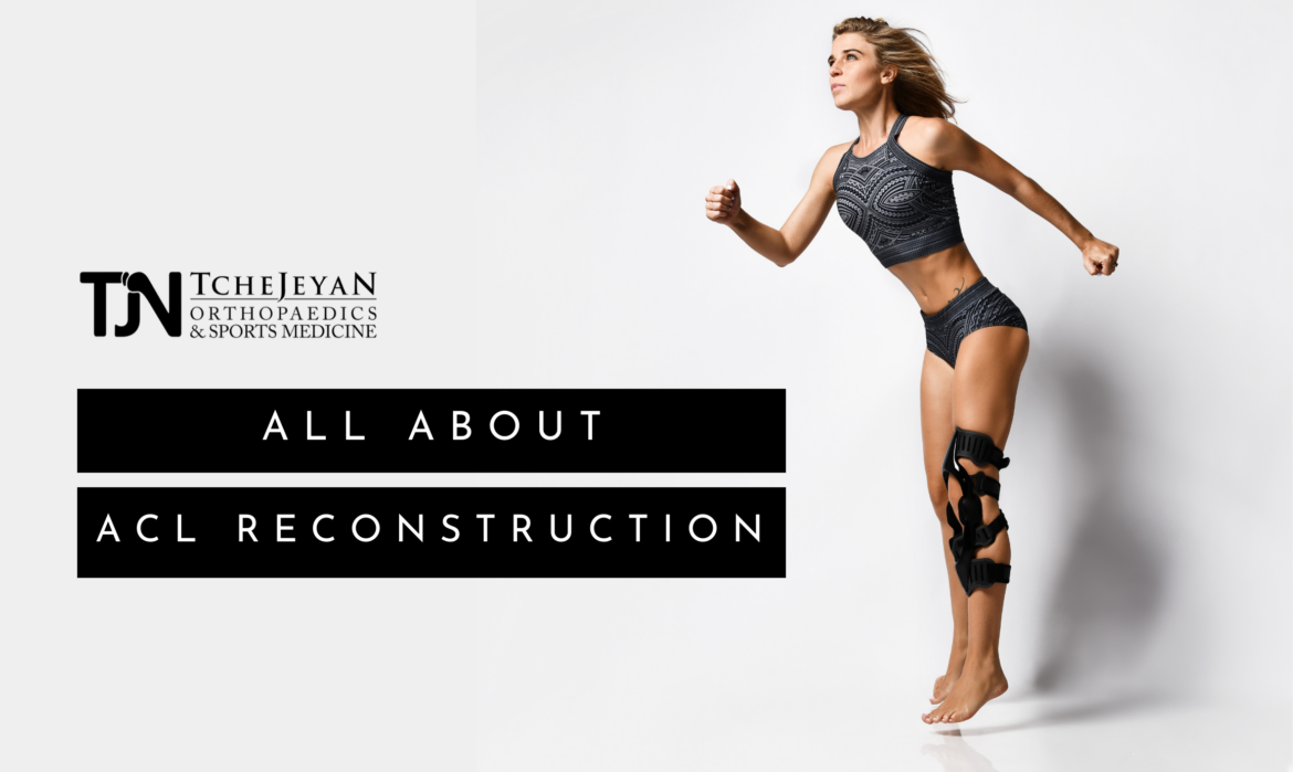 All About ACL Reconstruction