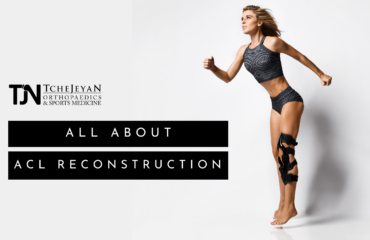 All About ACL Reconstruction