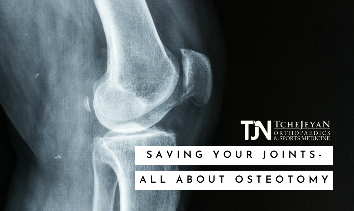 Saving Your Joints - All About Osteotomy