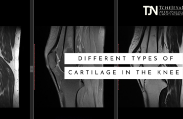 Different Types of Cartilage in the knee