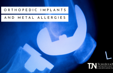 Orthopedic Implants & Metal allergies