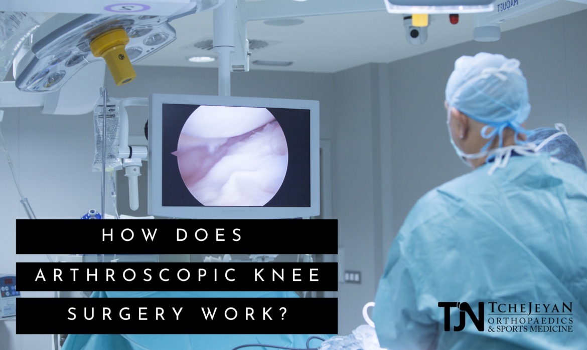 arthroscopic knee surgery