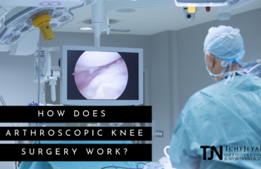 arthroscopic knee surgery