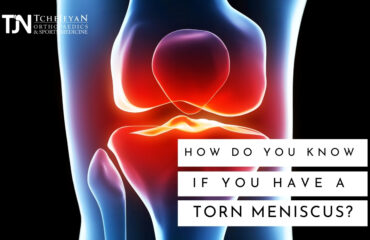 torn meniscus