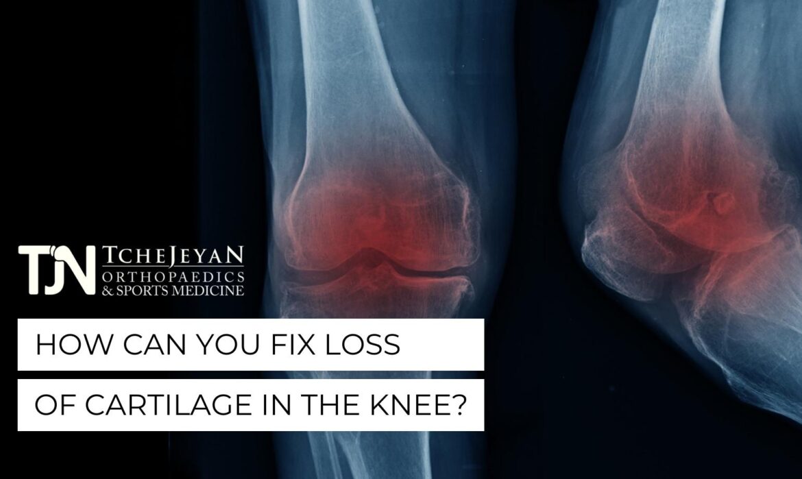 How Can You Fix Loss of Cartilage in the Knee?