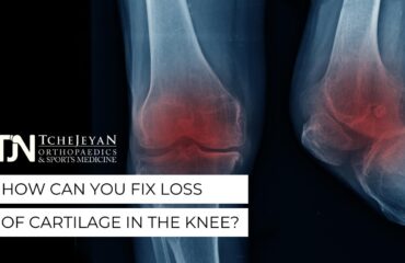 How Can You Fix Loss of Cartilage in the Knee?